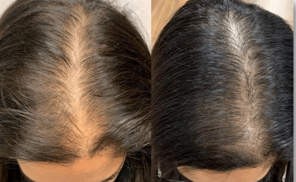 The Serum That ACTUALLY Makes A Difference: