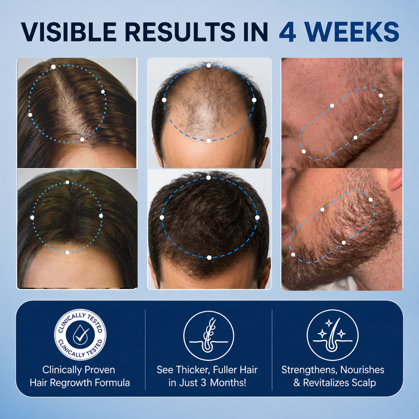 Hoegoa™ Rosemary Hair Growth Roller